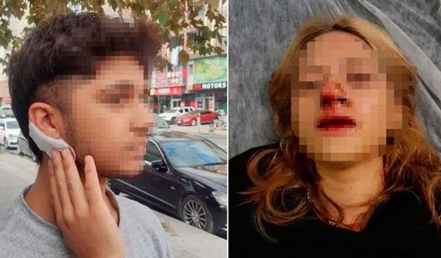 Sultangazi'de vahşet: Kaldırım taşıyla dişlerini kırdılar, yardıma gidenin kulağını kestiler